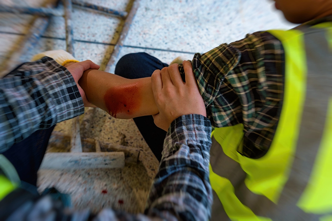 A person tends to an injured arm with a bloodied elbow, showing concern in a construction setting.